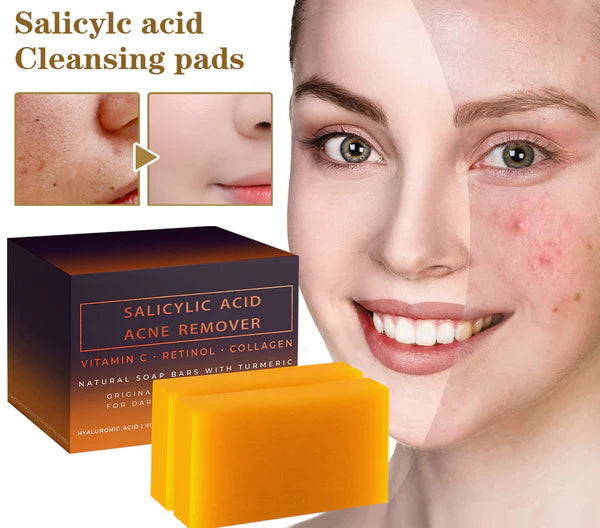 2023 NEW Warebrill Salicylic Acid Acne Remover 🔥Last Day Promotion 60% OFF