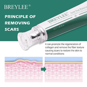 Scar removal cream skin care Acne Scar Removal Cream