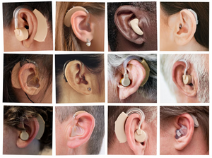 A Lasting Solution To Partial Deafness And Low Hearing Problems Finally Discovered！