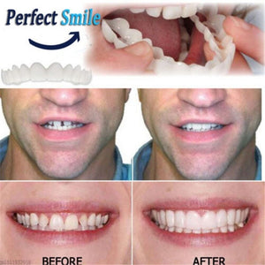 Adjustable Snap-On Dentures【Can eatting+General size】【The only genuine store!】