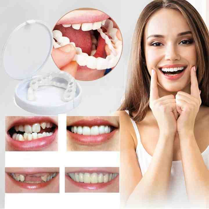 Adjustable Snap-On Dentures【Can eatting+General size】【The only genuine store!】