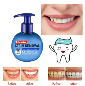 Intensive Stain Removal Whitening Toothpaste【🚚CASH ON DELIVERY + LOCAL STOCK (EXPRESS 3 DAY DELIVERY)】 TO2