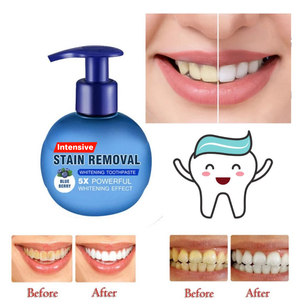 Intensive Stain Removal Whitening Toothpaste【🚚CASH ON DELIVERY + LOCAL STOCK (EXPRESS 3 DAY DELIVERY)】