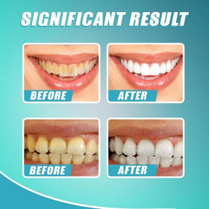 Intensive Stain Removal Whitening Toothpaste【🚚CASH ON DELIVERY + LOCAL STOCK (EXPRESS 3 DAY DELIVERY)】